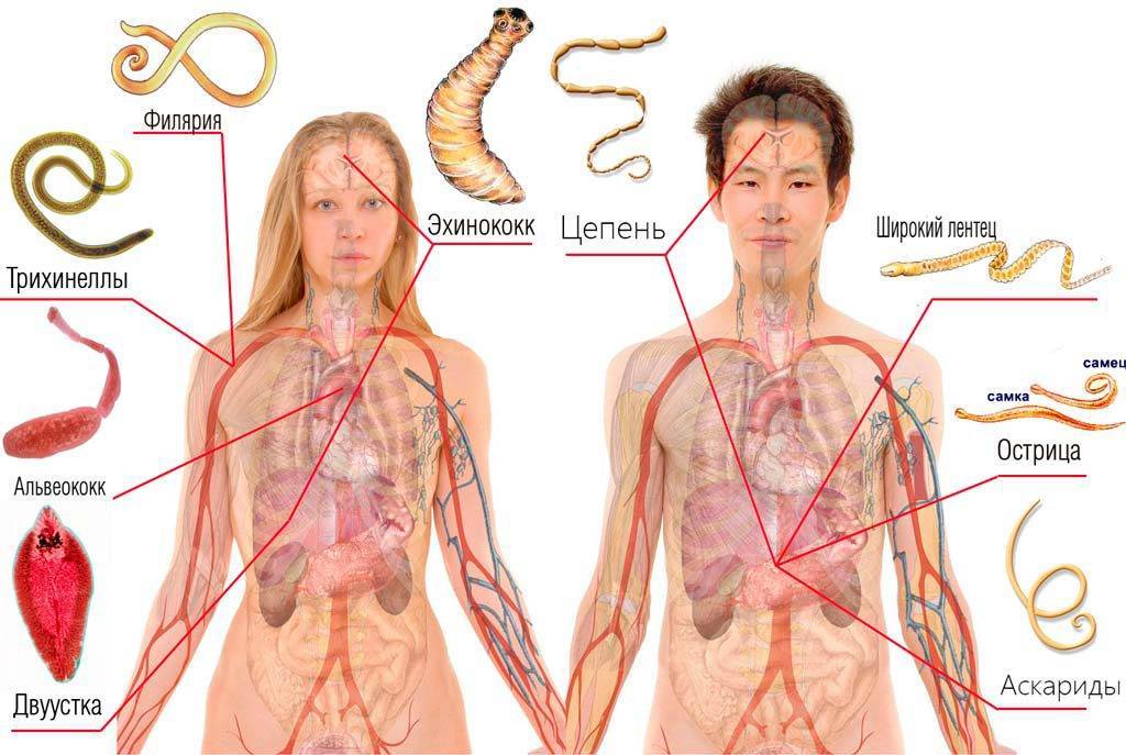 21 признак, что в теле живут паразиты